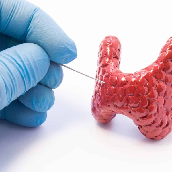 Punción tiroides Dra  Monserrat Acosta