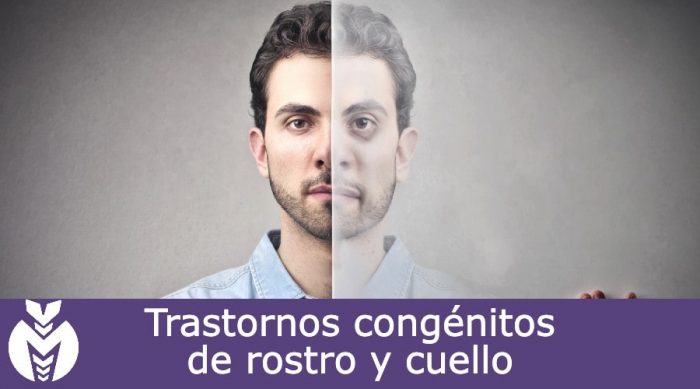 Trastornos congénitos de rostro y cuello Dra Monserrath Acosta Trastornos congénitos de rostro y cuello Dra Monserrath Acosta